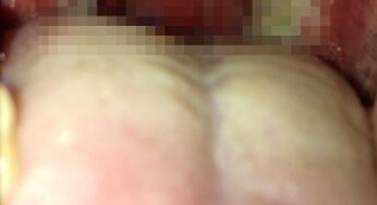 大人なのに溶連菌感染症になり高熱が出た